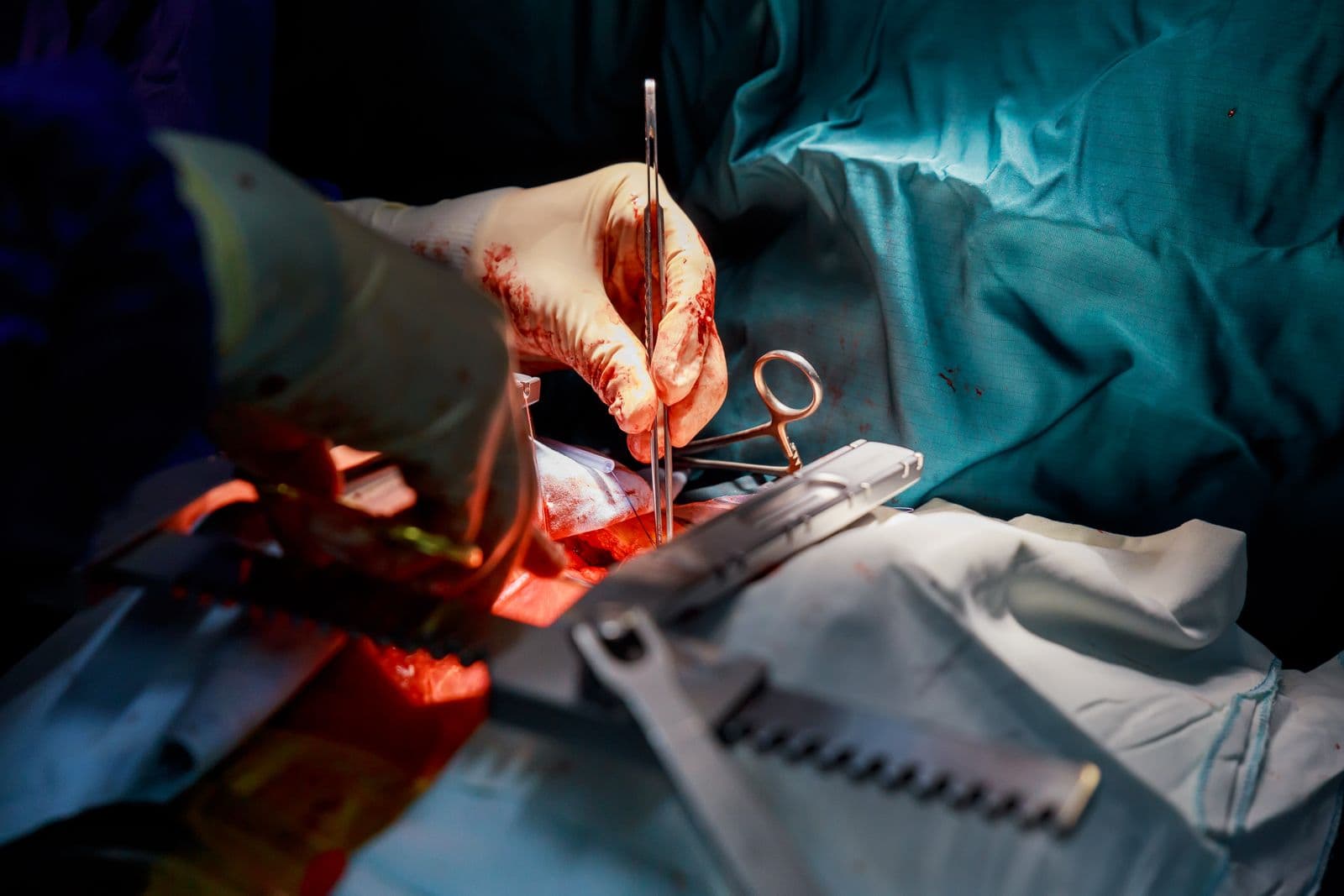 Surgical Solution